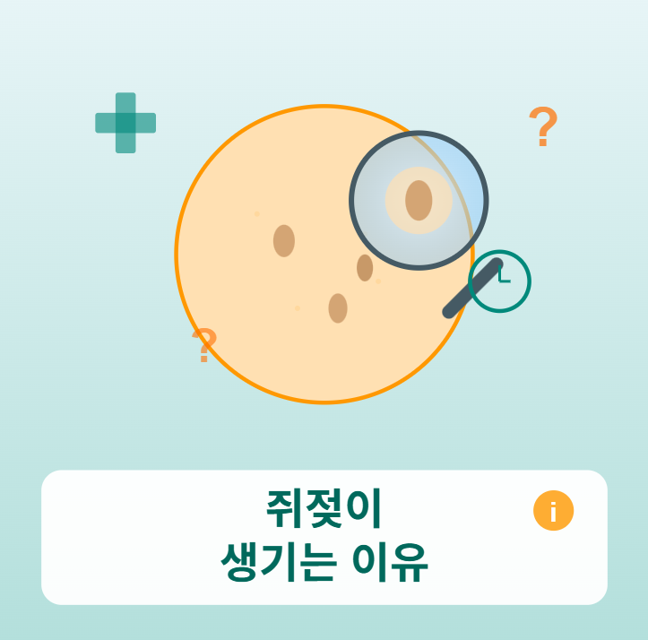 쥐젖이 생기는 이유