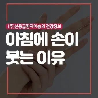 손등 붓는 이유 혈액순환 문제 증상과 해결법 정리_26