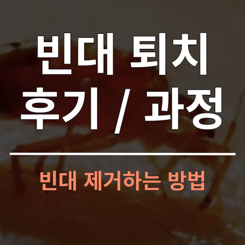 빈대 퇴치 후기 및 과정