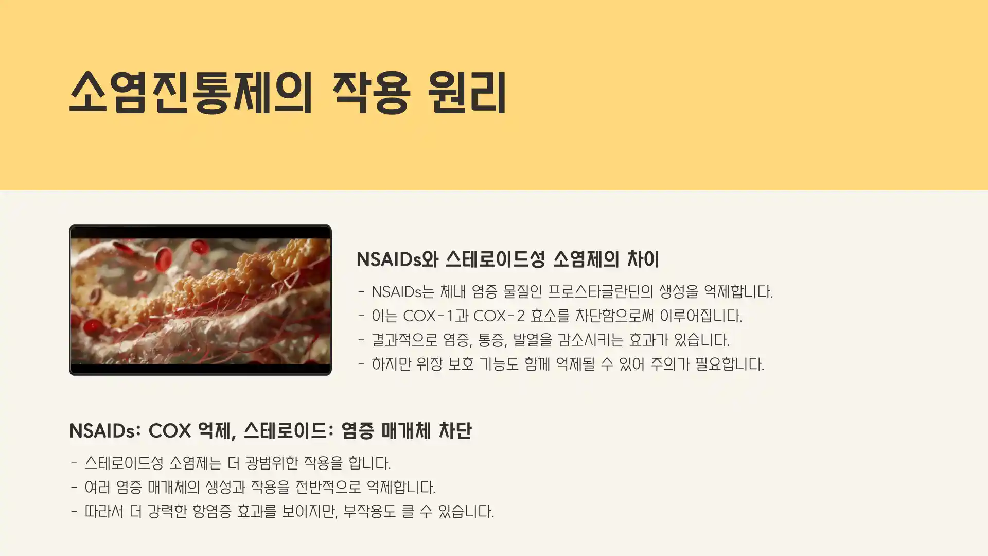 소염진통제 종류