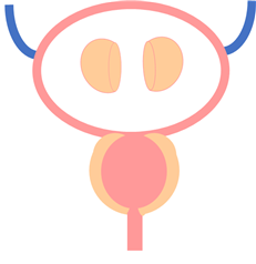 경요도전립선적출술