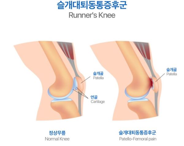 러너스니 달리기 러닝 마라톤