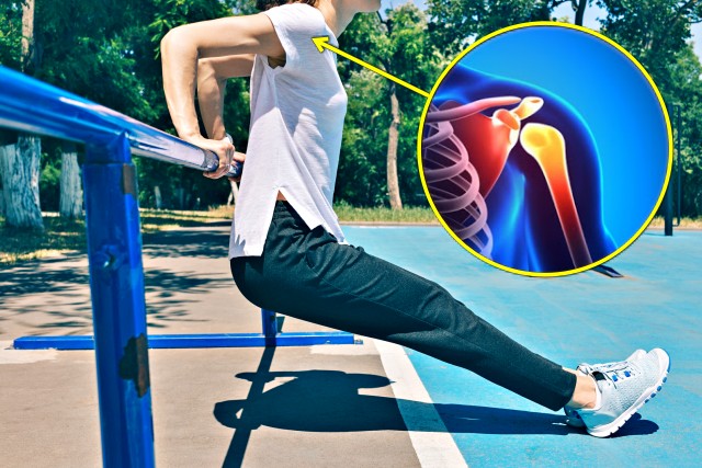 어깨 회전근개 안좋은 운동 딥스, 건강 팁줌 매일꿀정보