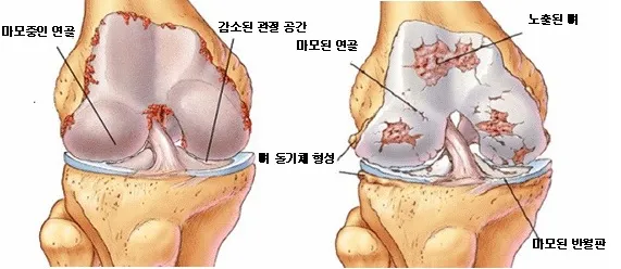관절염에 좋은 음식 TOP 10_9
