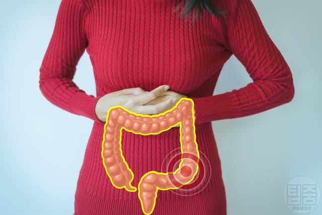 대장암 전조증상 4기 대장암증상