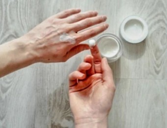 주부습진 보습제