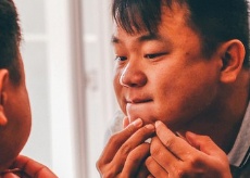 노스카나겔 가격, 사용법, 효과, 파는곳