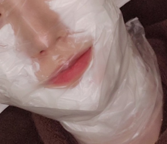 스킨보톡스 후기