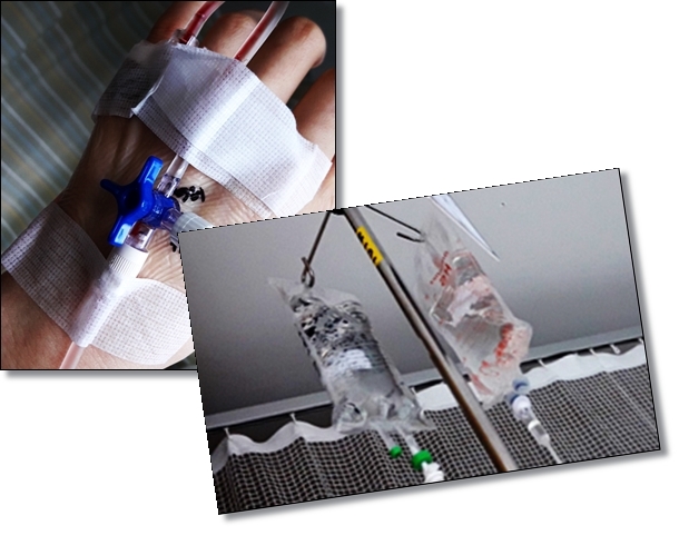 망막전막-유리체절제술-후기-과정-비용