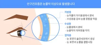 눈물이 자주 나는 이유에 대한 안과정보_16