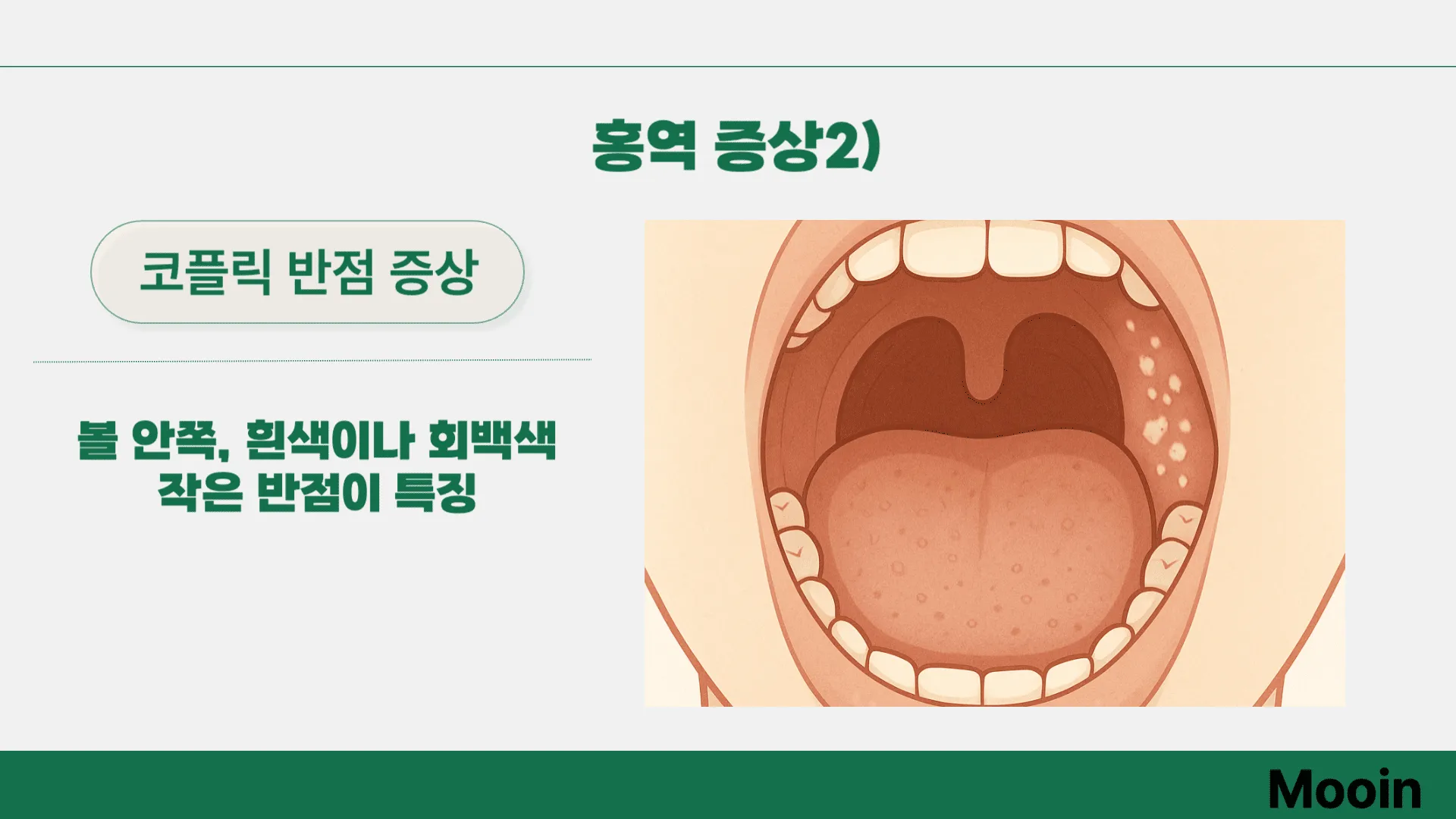 홍역 증상2)
