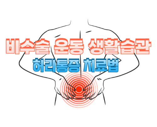 허리 통증 치료법