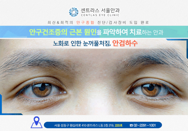 안검하수 관련 이미지