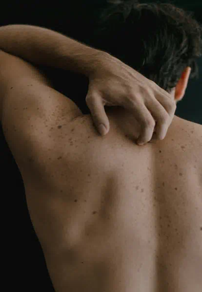 대상포진 초기증상 관련사진8