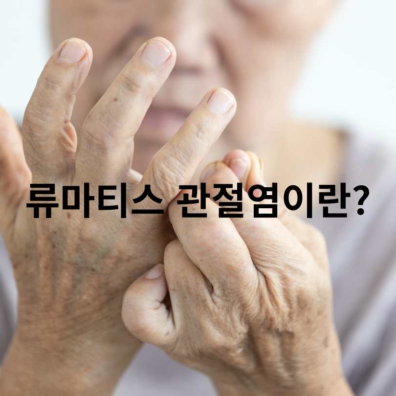 류마티스 관절염 진단법 총정리! 정확한 검사방법과 초기 대처법