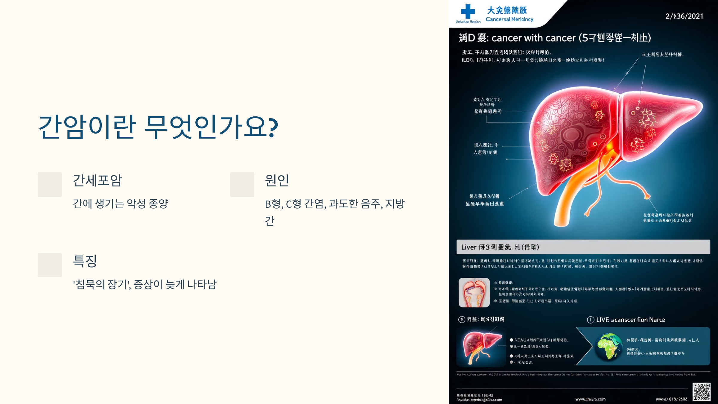 간암이란 무엇인가요?