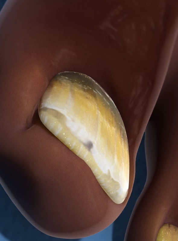 발톱이 검게 변하는 이유