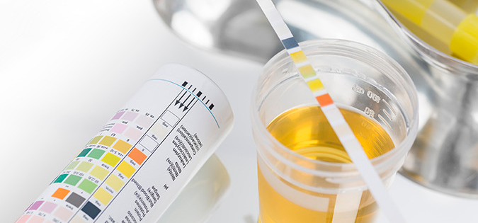 소변-측정-시험지