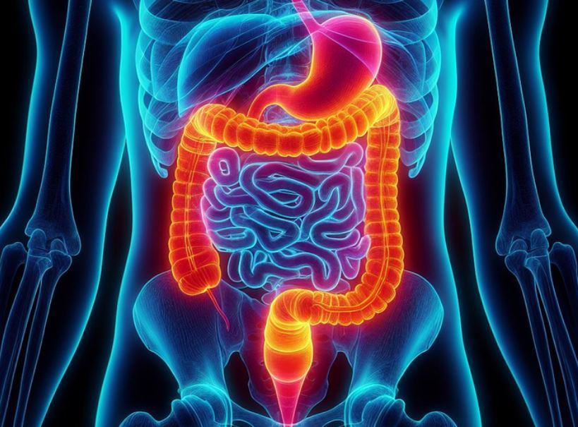 대장암 예방방법