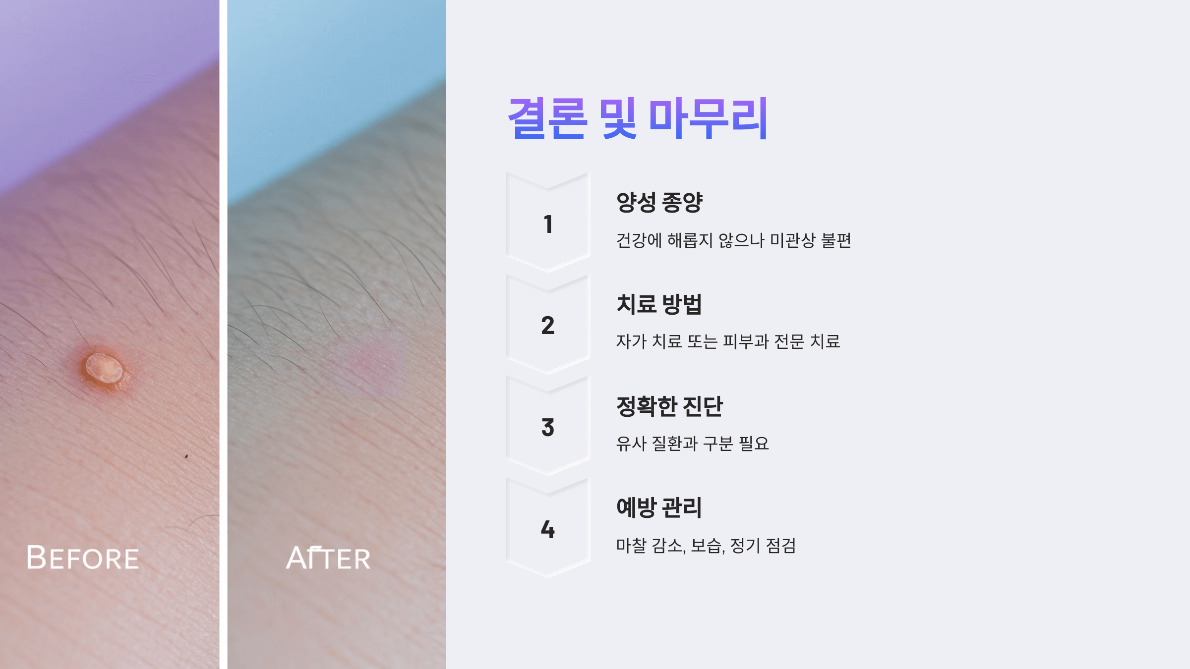 쥐젖과 관련된 사진입니다.