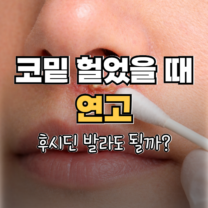 코 밑 헐었을 때 연고 후시딘 발라도 될까? (진물, 고름날 때)
