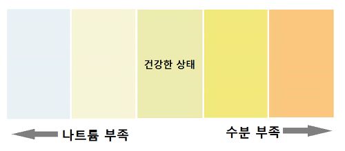 오줌 색깔과 병