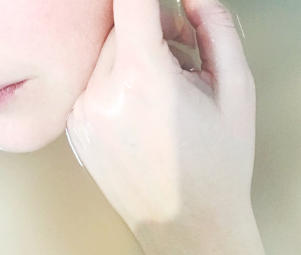 빈혈 증상 : 창백한 피부