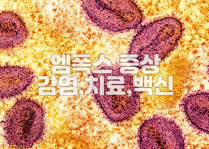 엠폭스 바이러스 이미지