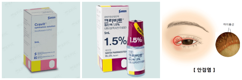 크라비트점안액, 안검염 사진