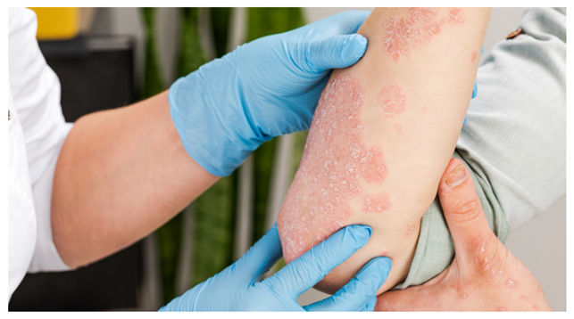 피부과 의사-하는일-업무환경-되는법-학과-전망