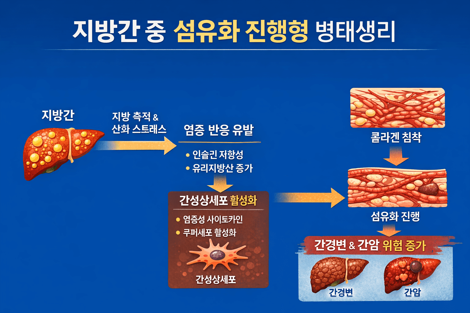 지방간 중 섬유화 진행형