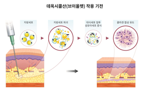 브이올렛