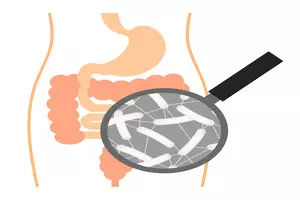 대장암-4기-생존율