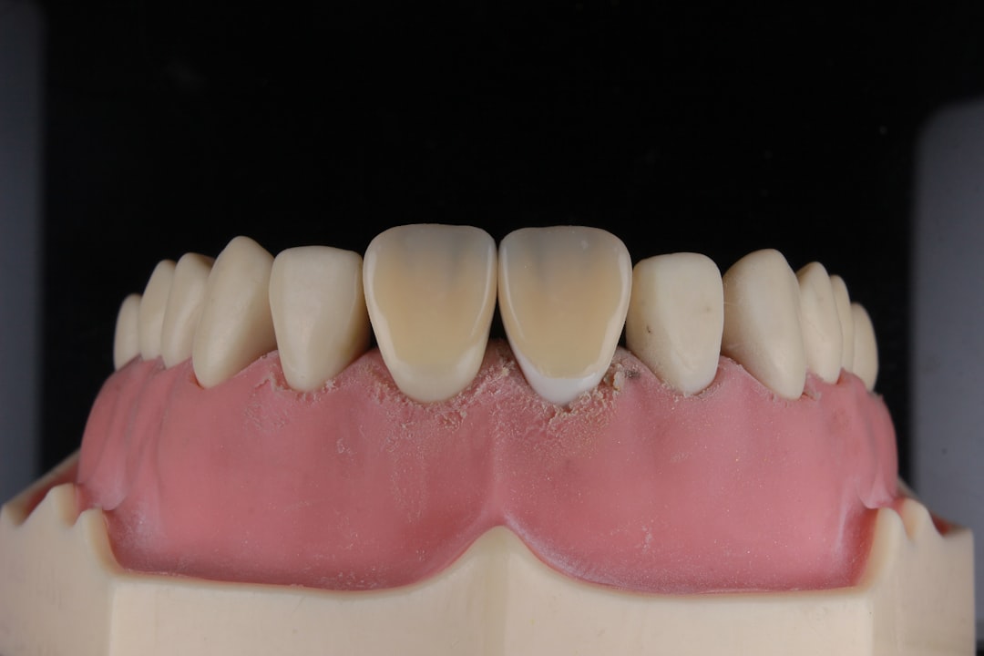 Implant