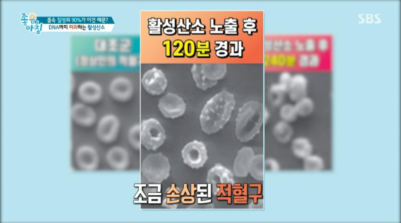 숨만 쉬어도 활성 산소가 생긴다?