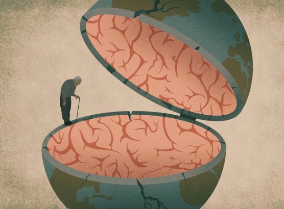 치매 검사 방법