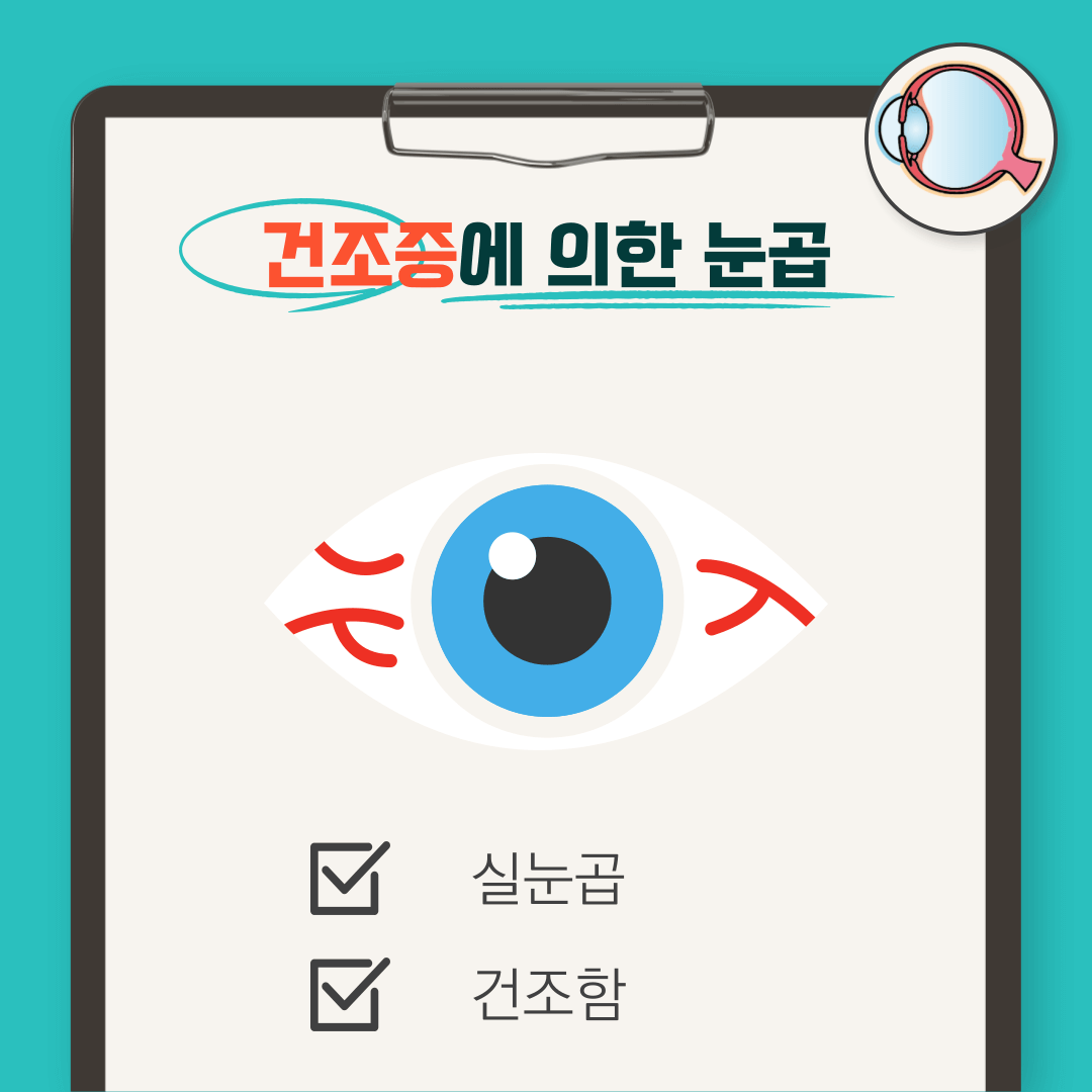눈곱 끼는 이유: 눈곱 자주 끼는 이유