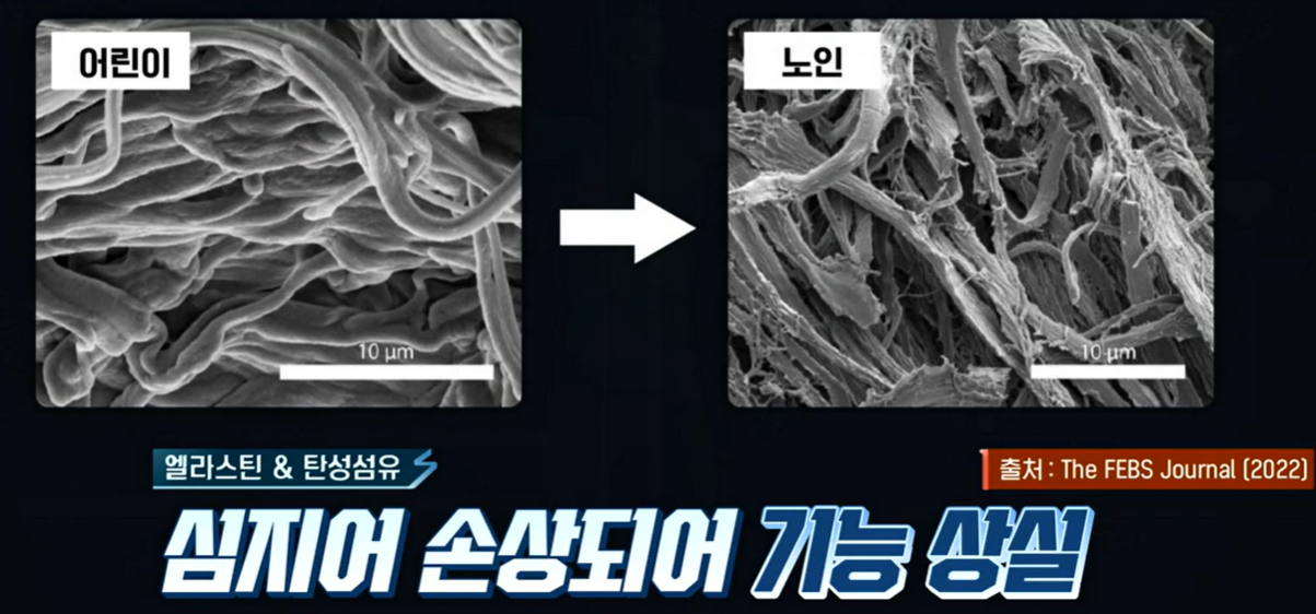 콜라겐과 엘라스틴이 중요한 이유