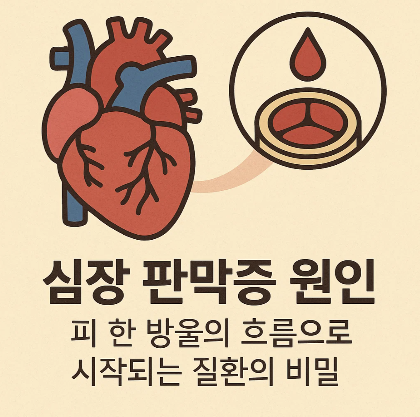 심장 판막증 원인, 피 한 방울의 흐름으로 시작되는 질환의 비밀