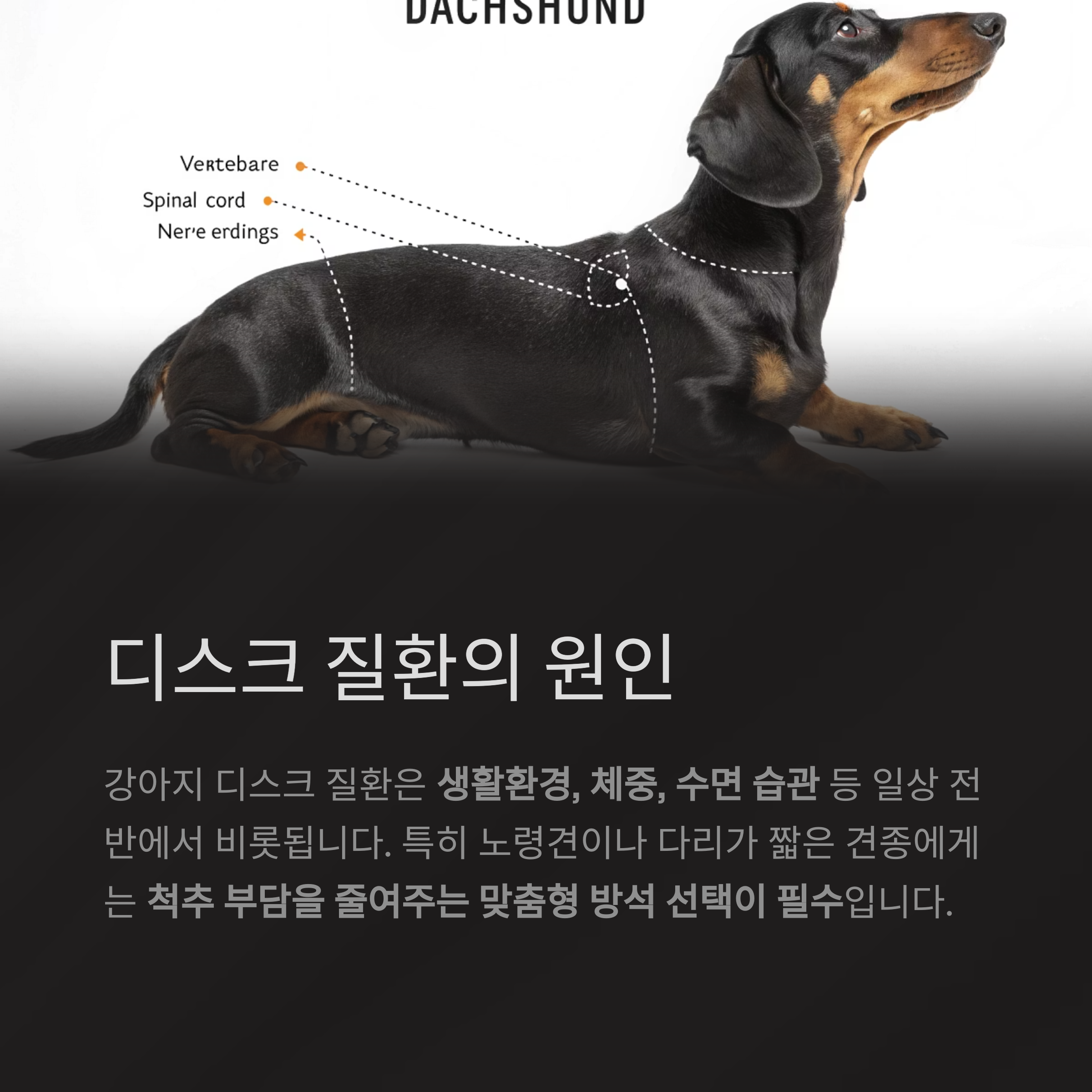 디스크 질환의 원인