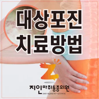 대상포진 치료방법에 대한 총정리 건강 질병관리_21