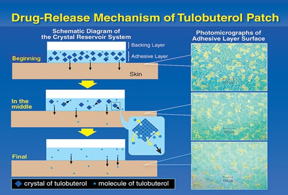 Tulobuterol-약물전달과정
