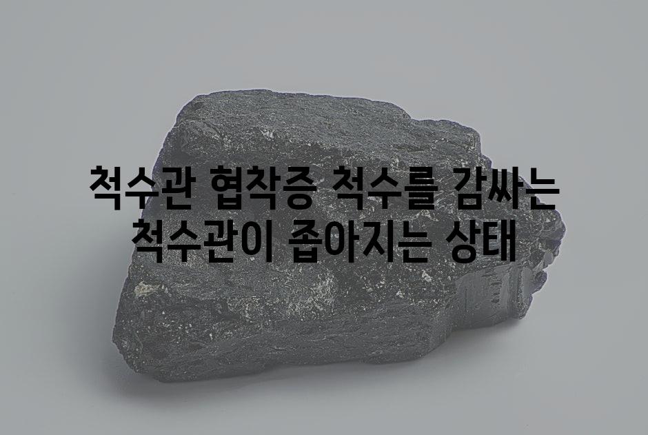척수관 협착증 척수를 감싸는 척수관이 좁아지는 상태