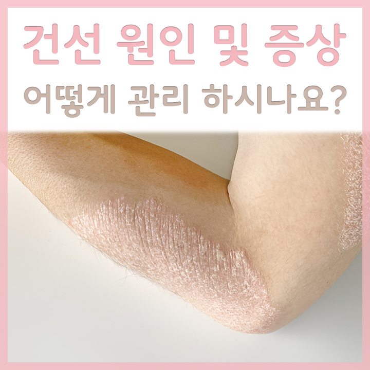 피부에-건선이-심하게-발생한-모습