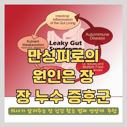 만성 피로를 달고 계신 분은 장 건강을 챙기세요 썸네일