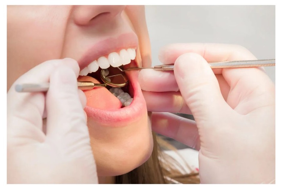 이빨 검진 하는 이미지