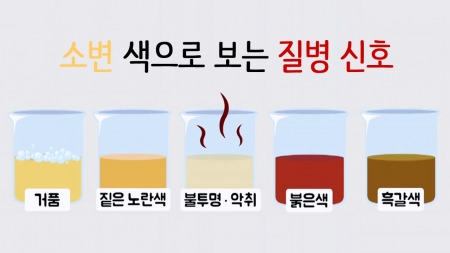 소변 색에 따른 질병 신호/ 출처 - 네이버포스트[국민건강보험일산병원]