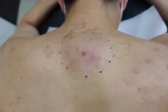 남자 얼굴 피지 제거 화장품 꿀템_18