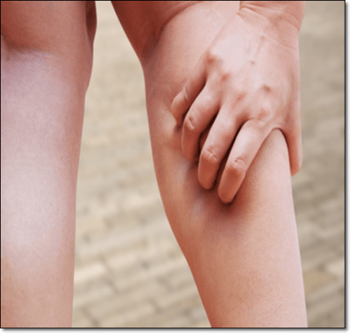 다리에 쥐난 여성