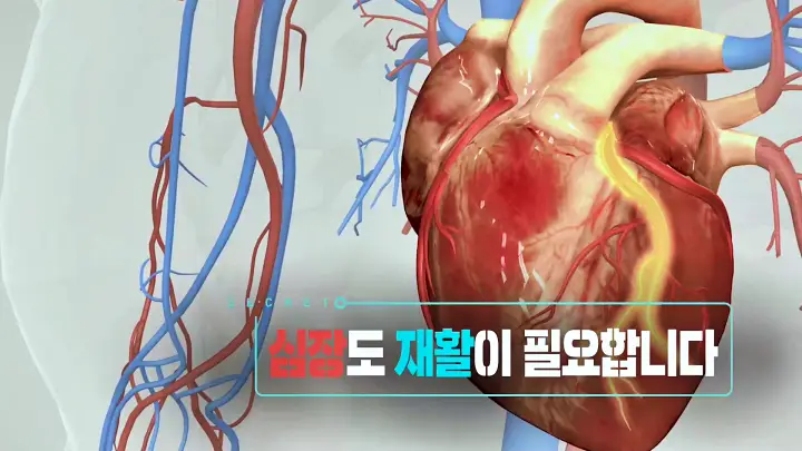 KBS 생로병사의 비밀 818회 급성 심근경색 심부전 협심증 심혈관 질환자를 위한 심장 재활 효과